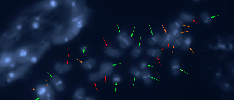 Image of peanut chromosomes made through karyotyping